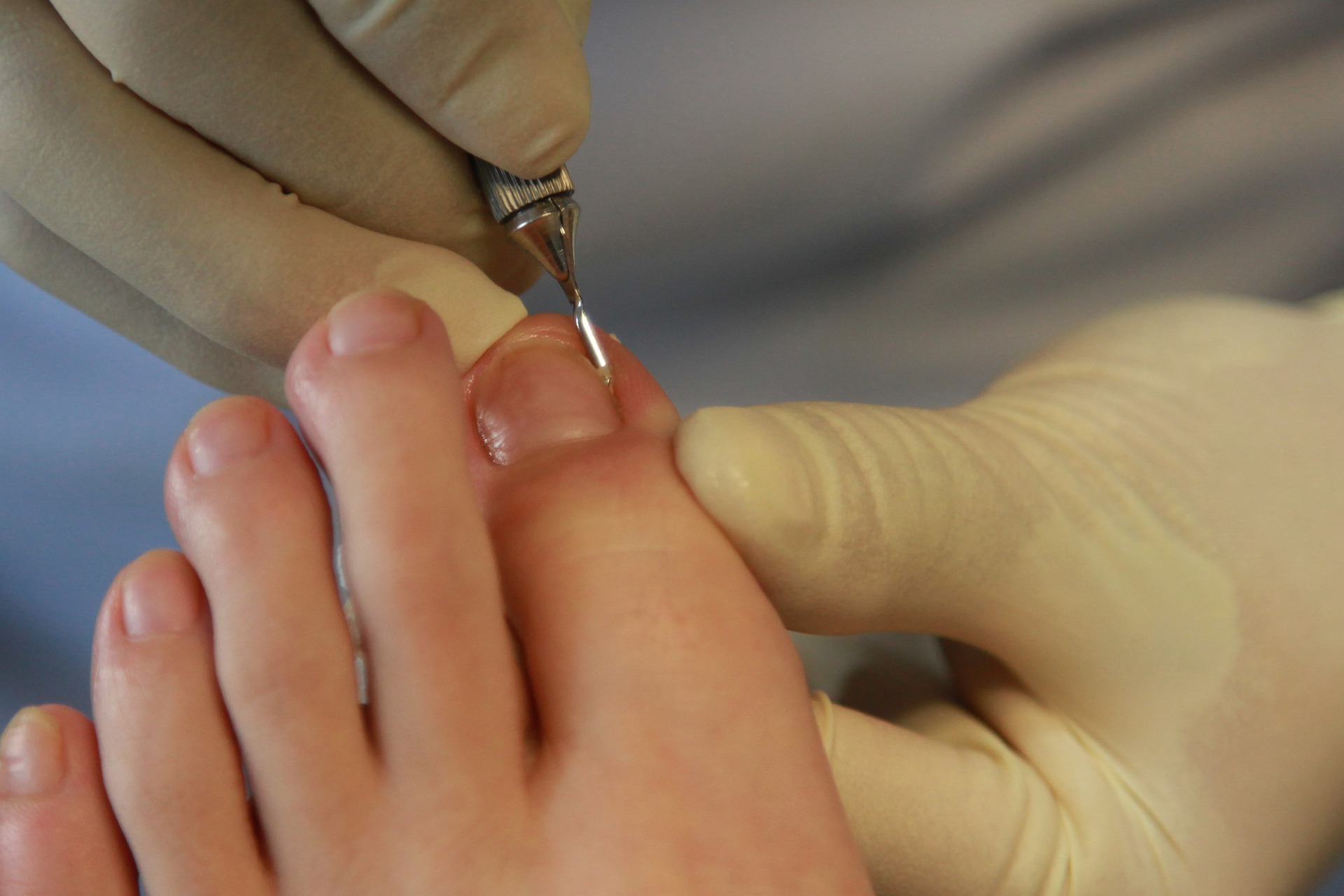 toenails-g12155b54f_1920